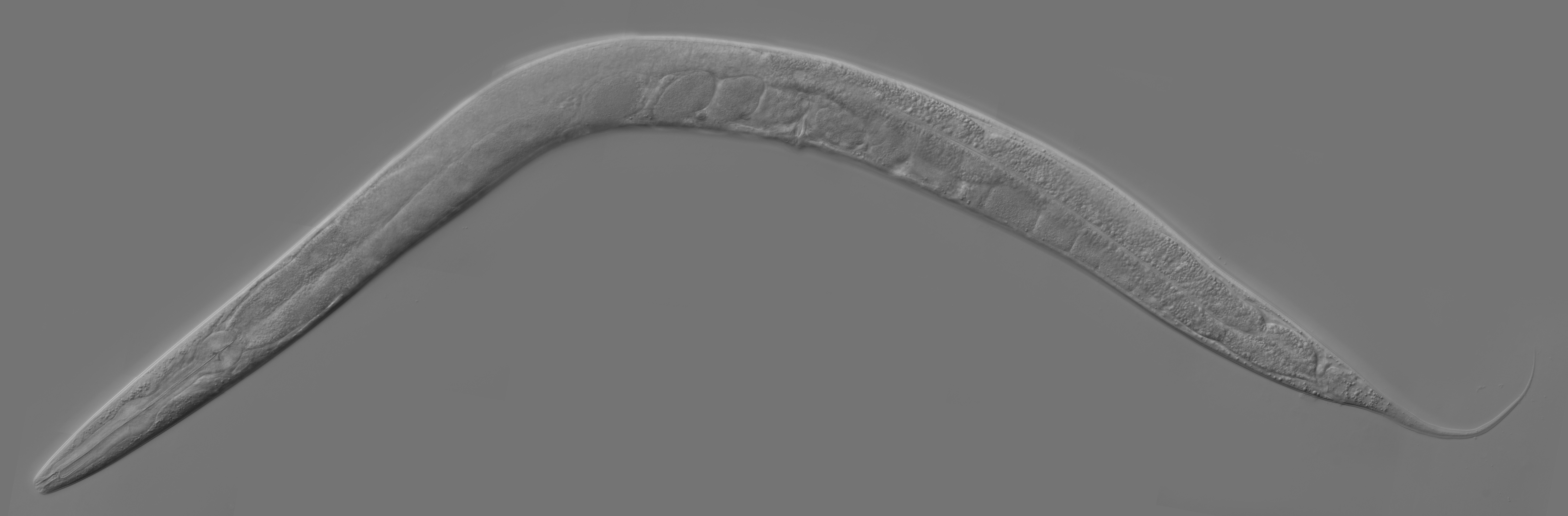 Adult C. elegans hermaphrodite under differential interference contrast microscopy
